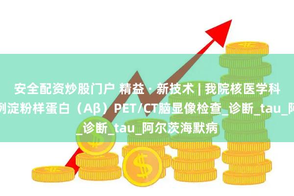 安全配资炒股门户 精益 · 新技术 | 我院核医学科顺利完成首例淀粉样蛋白（Aβ）PET/CT脑显像检查_诊断_tau_阿尔茨海默病